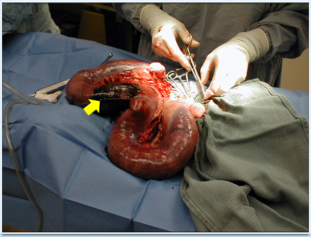 Picture: An infected uterus. The blackened area (indicated by a yellow arrow) shows an infected uterusready to rupture.
